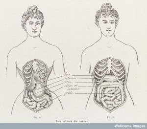 L0038404 Illustrations to denounce the crimes of the corset Credit: Wellcome Library, London. Wellcome Images images@wellcome.ac.uk http://wellcomeimages.org 2 Illustrations to denounce the crimes of the corset and how it cripples and restricts the bodily organs in women. Engraving 1908 Published: - Printed: 10th October 1908 Copyrighted work available under Creative Commons by-nc 2.0 UK, see http://wellcomeimages.org/indexplus/page/Prices.html